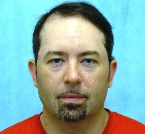 Hair Transplant