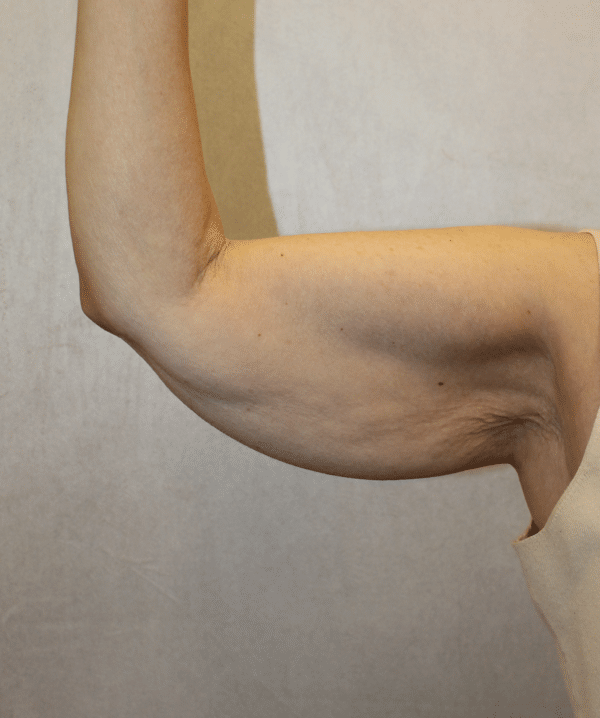 Body Procedures