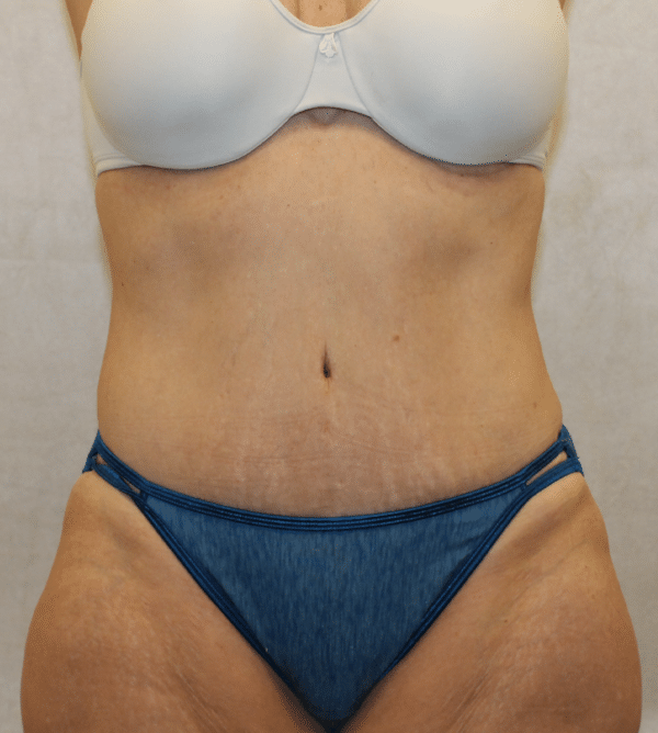 Body Procedures