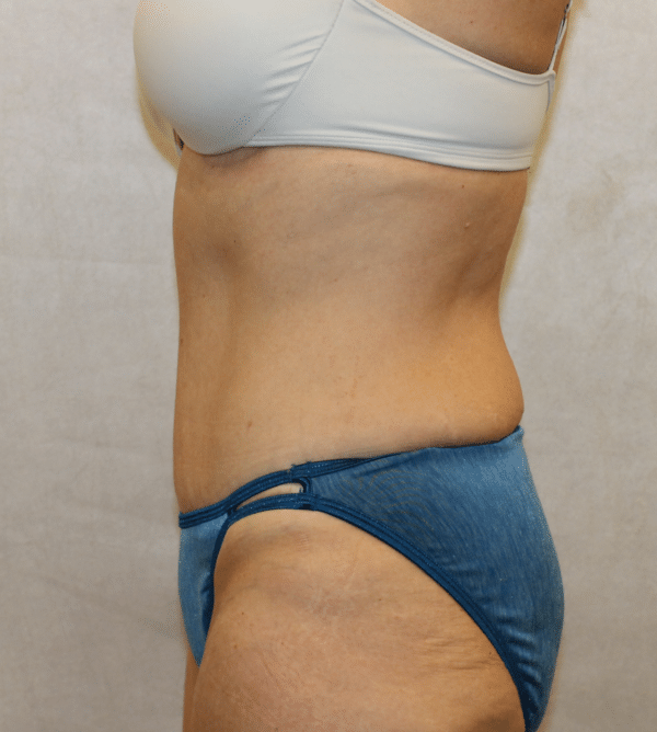 Body Procedures