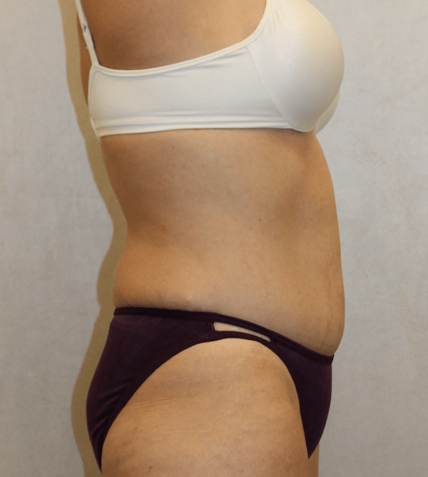 Body Procedures