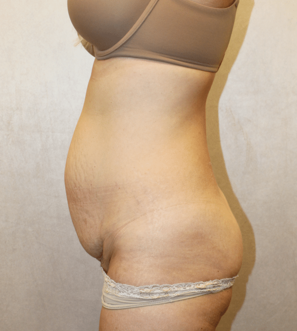 Body Procedures