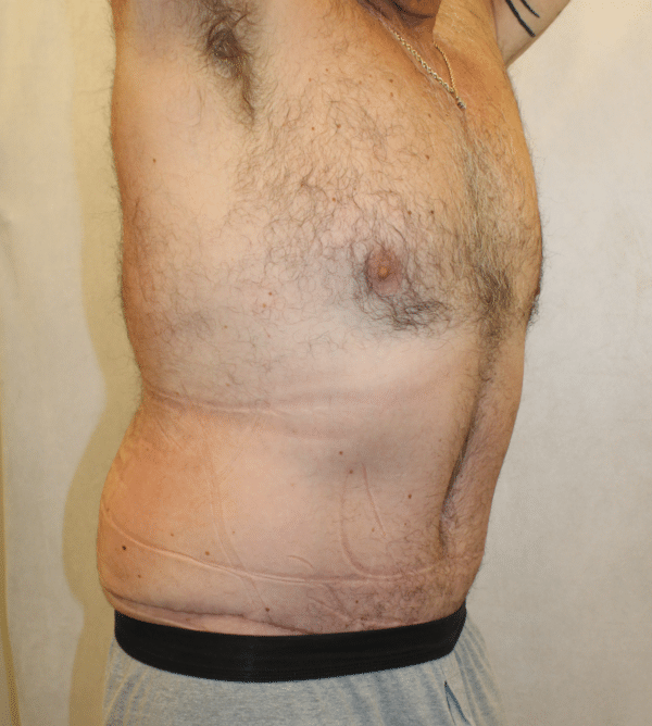 Body Procedures