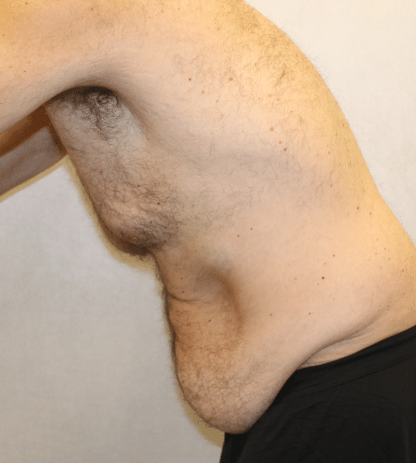 Body Procedures