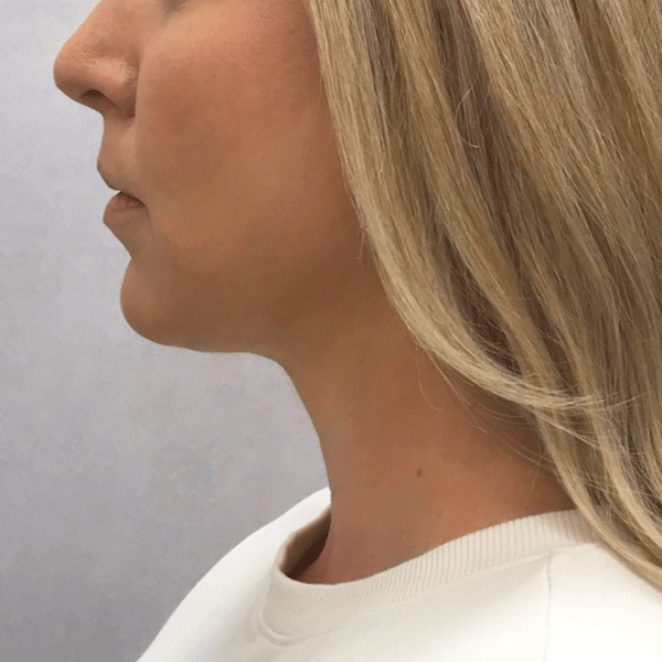 Face Procedures