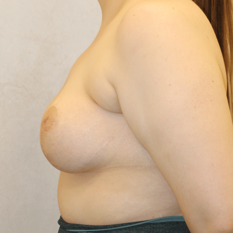 After Image