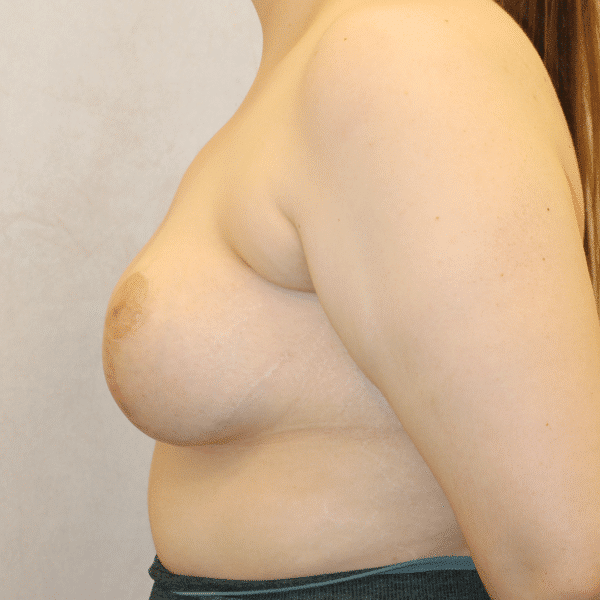 After Image
