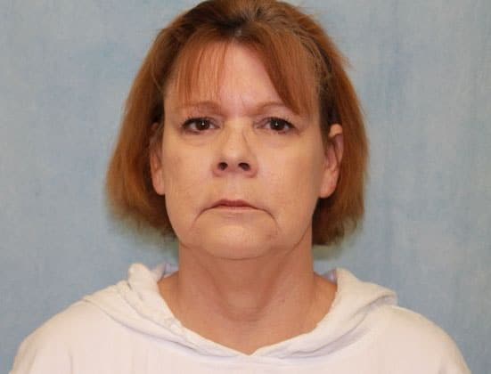 Before Image: Case #339 – Facelift - front