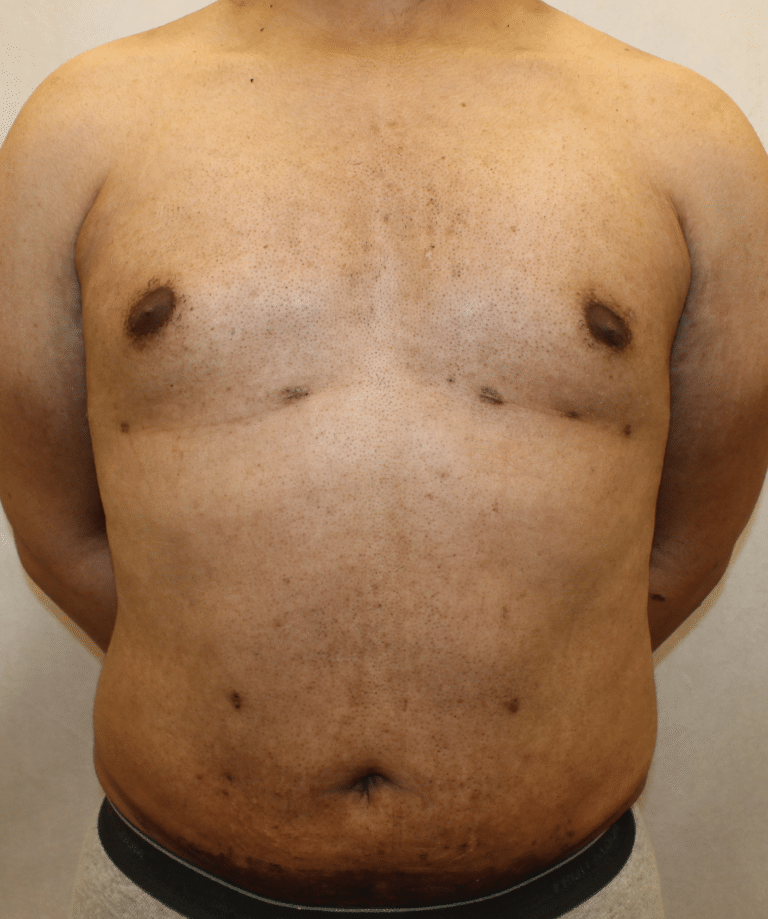 After Image