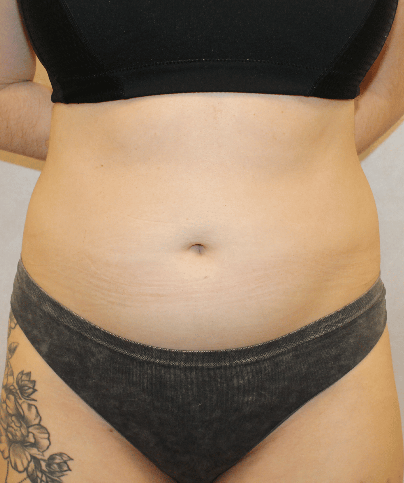 Before Image:  - front
