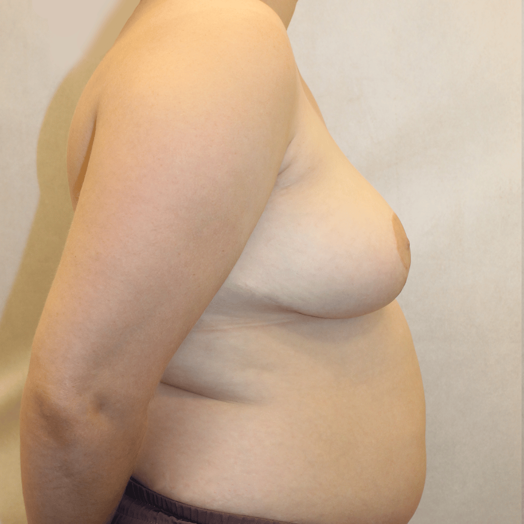 After Image:  - right-side