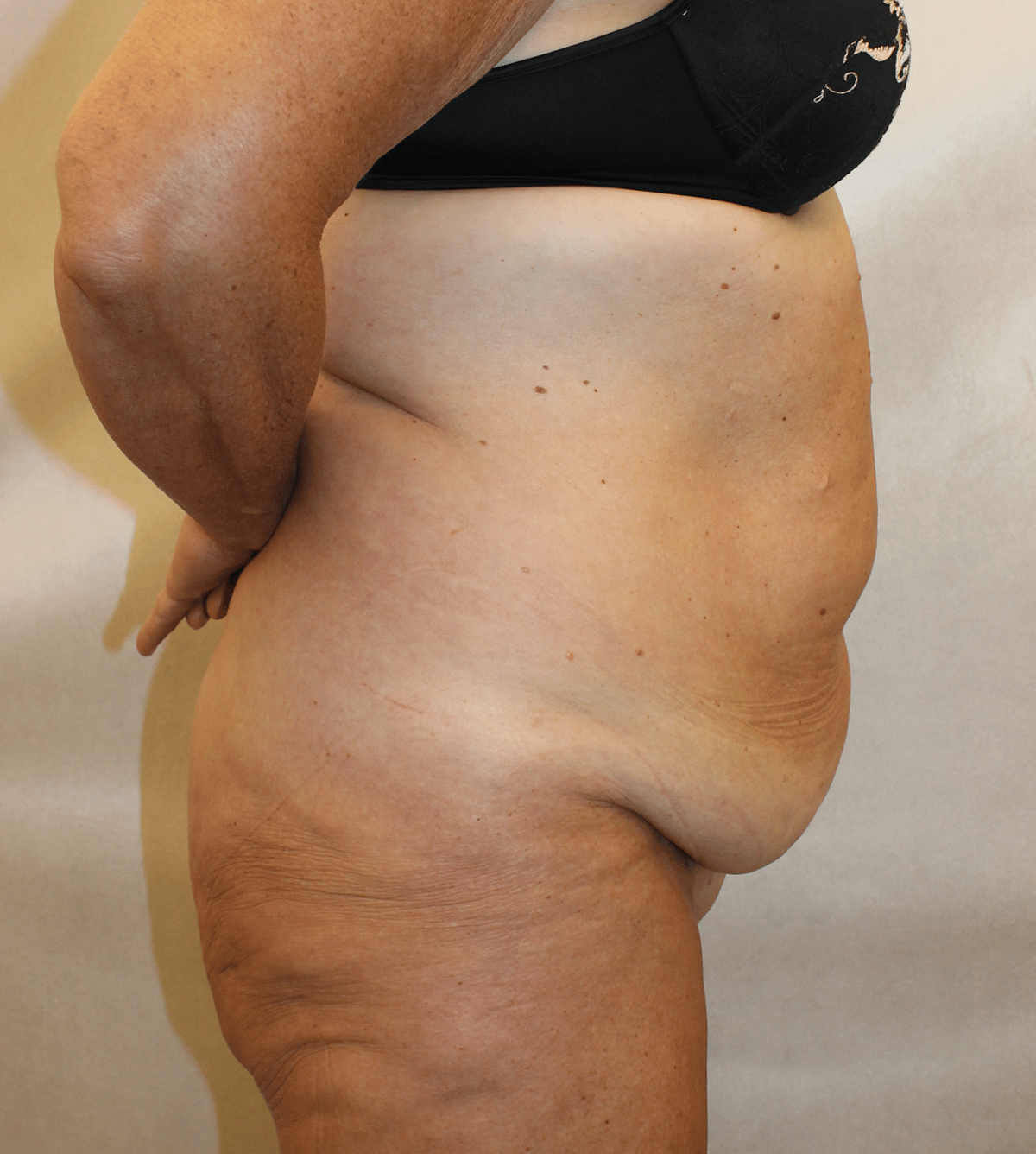 Before Image:  - right-side