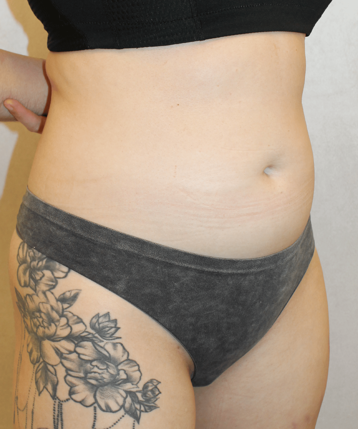 Before Image:  - right-front-oblique