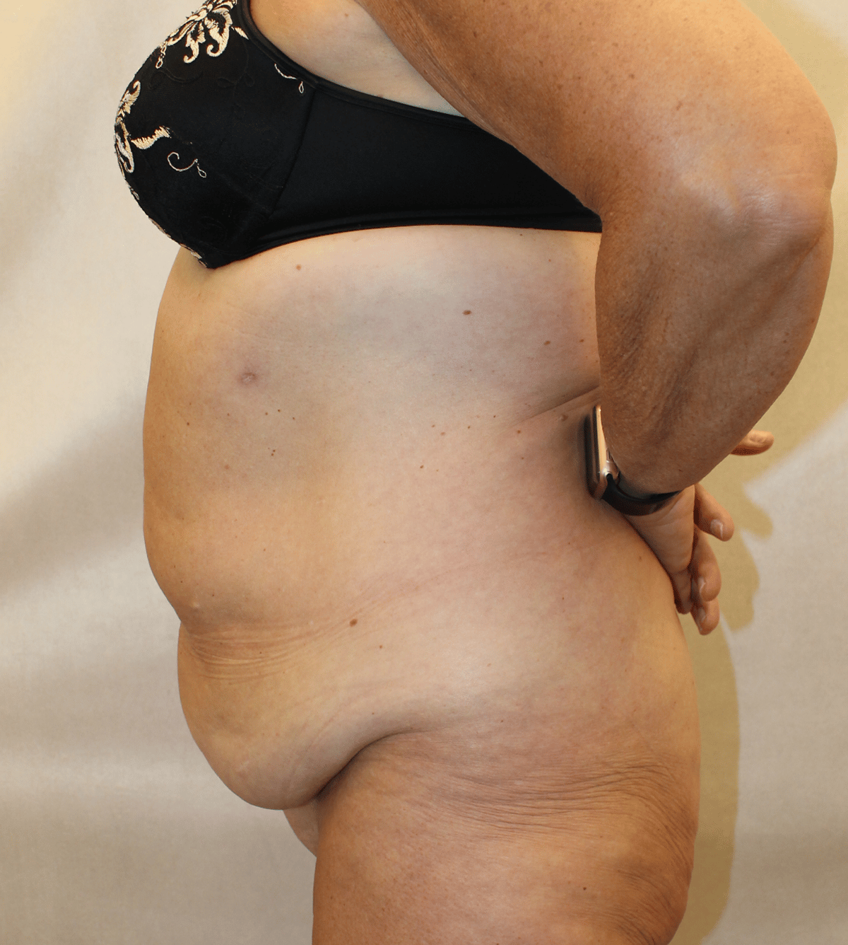 Before Image:  - left-side
