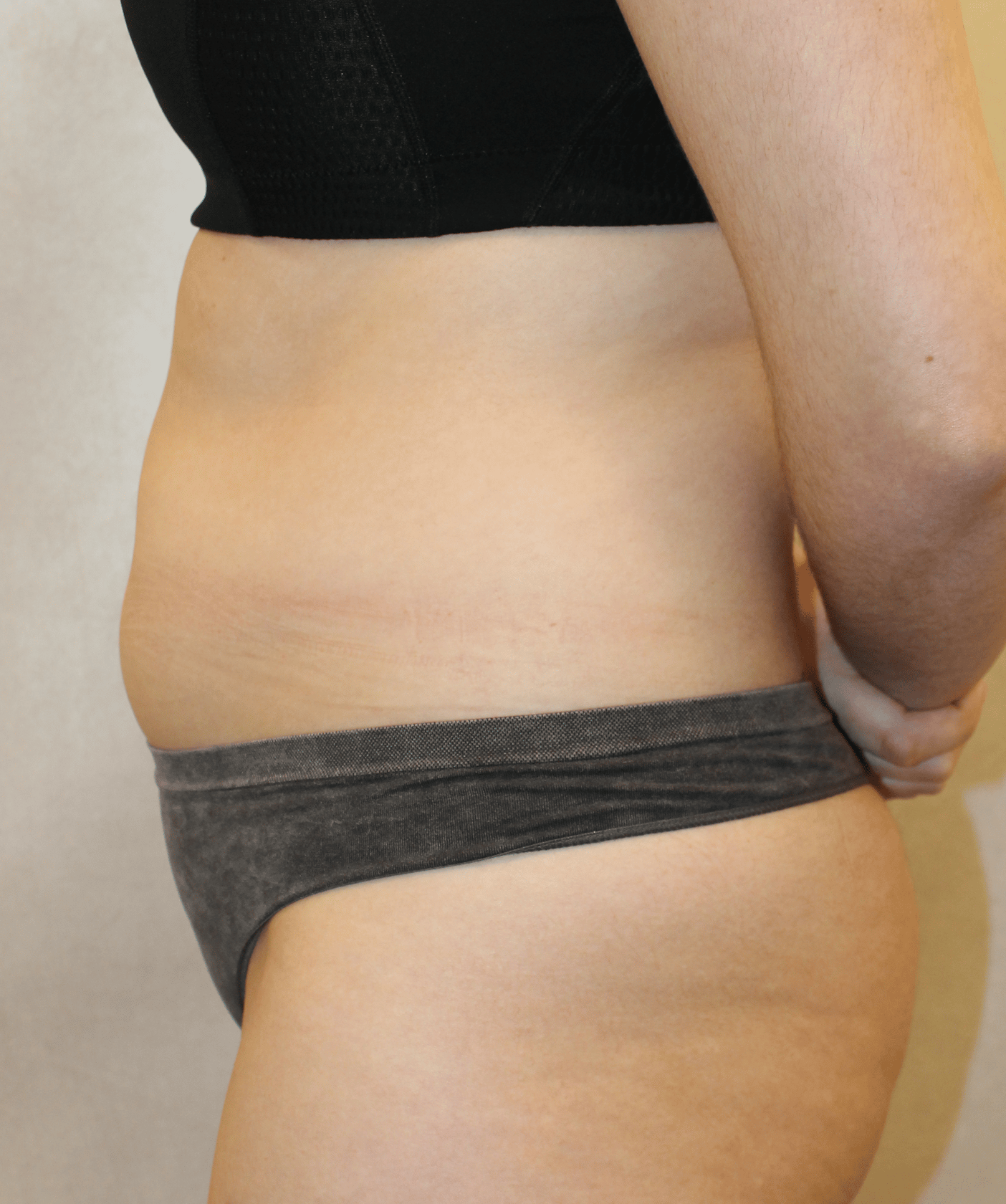 Before Image:  - left-side