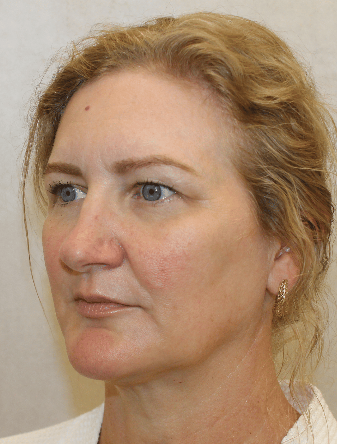 Before Image:  - left-front-oblique