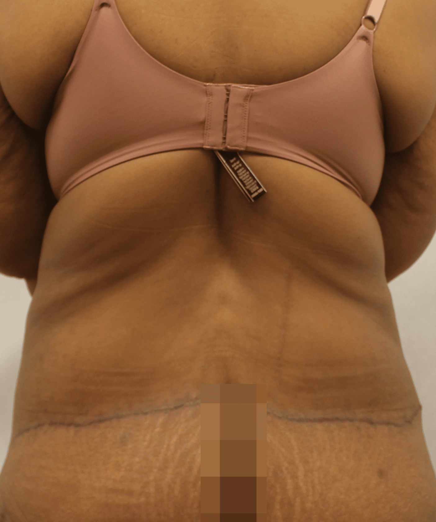Before Image:  - back