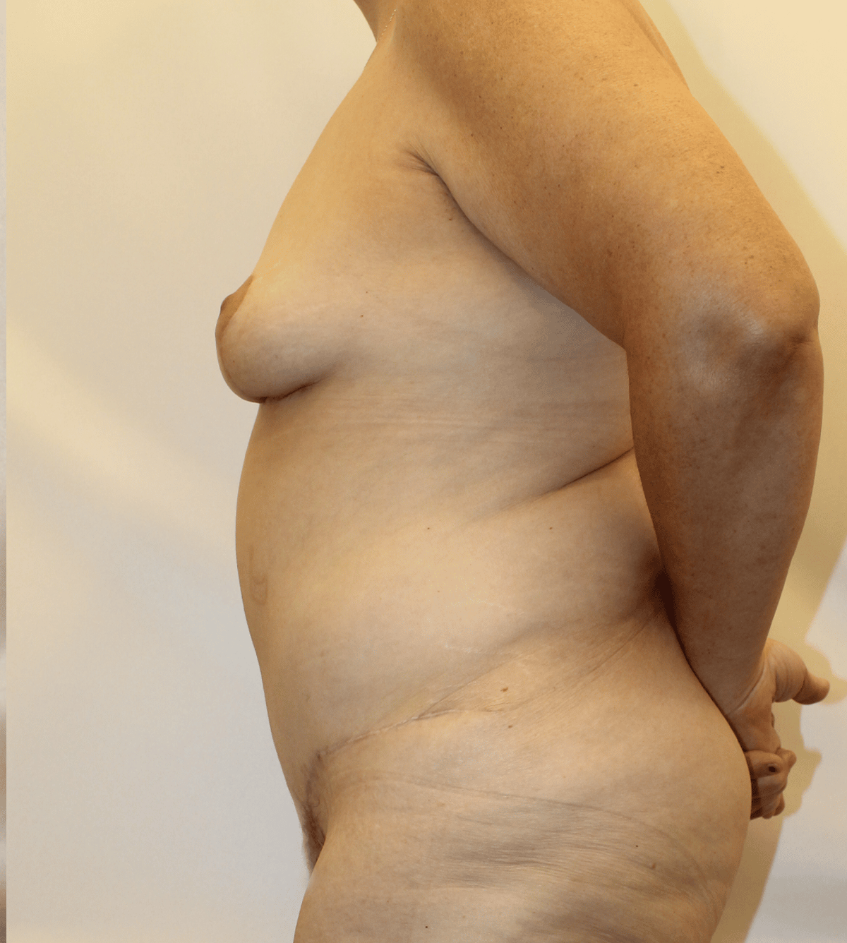 After Image:  - left-side