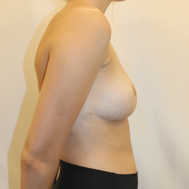 After Image