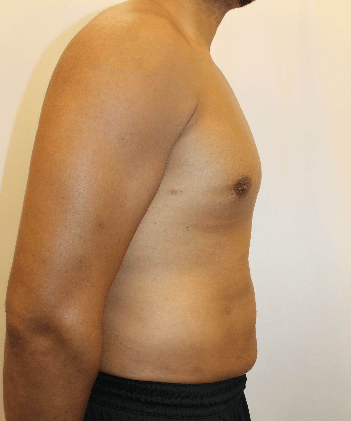 After Image:  - right-side