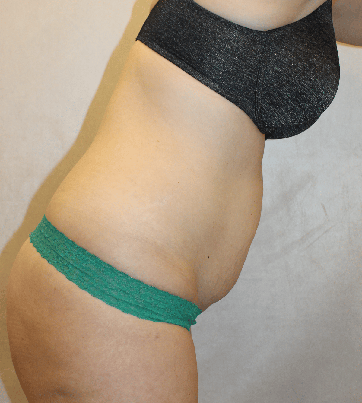 Before Image:  - other