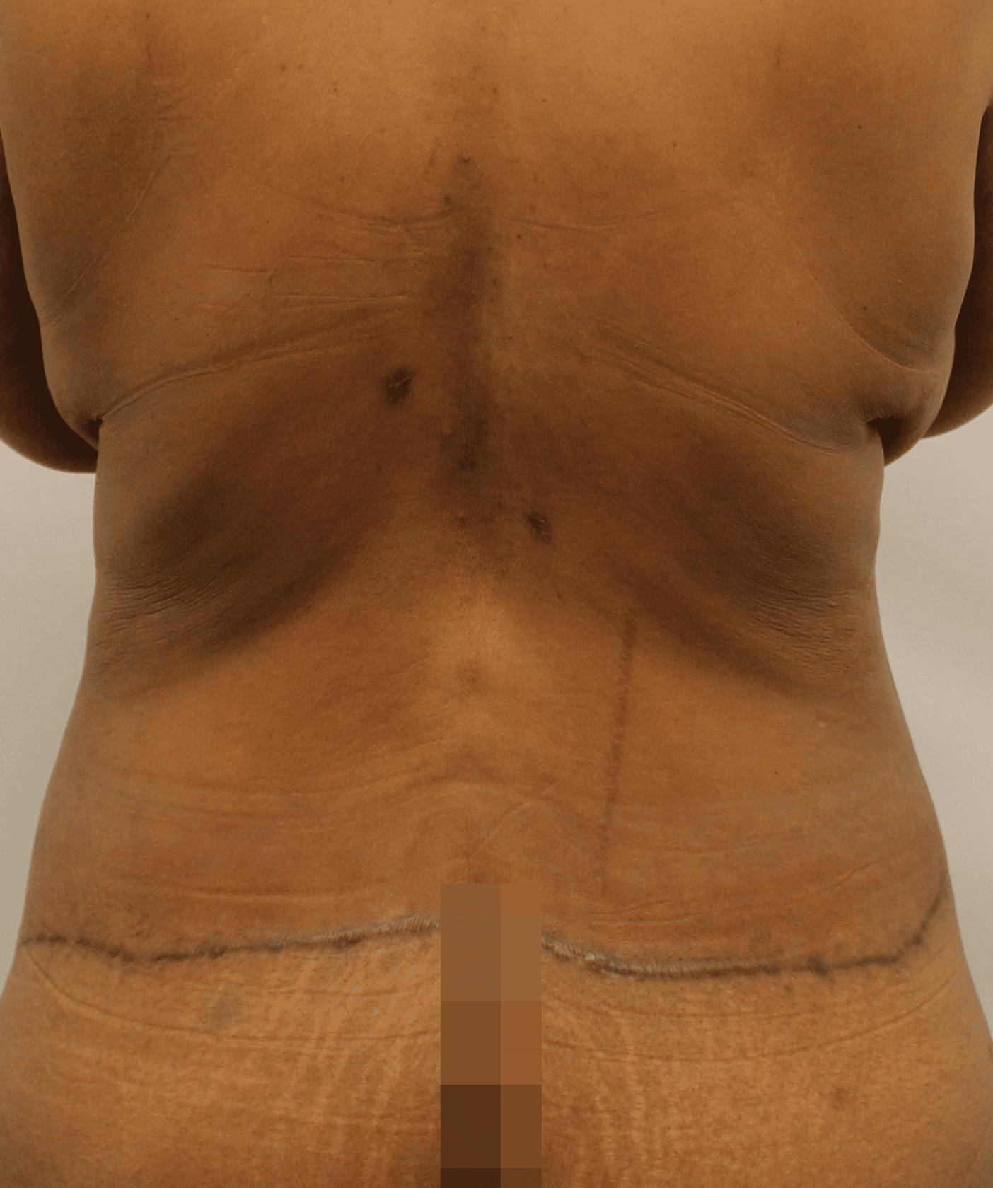 After Image:  - back