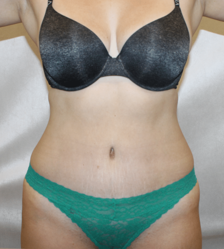 After Image