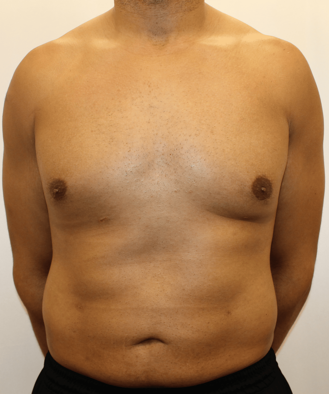 After Image:  - front