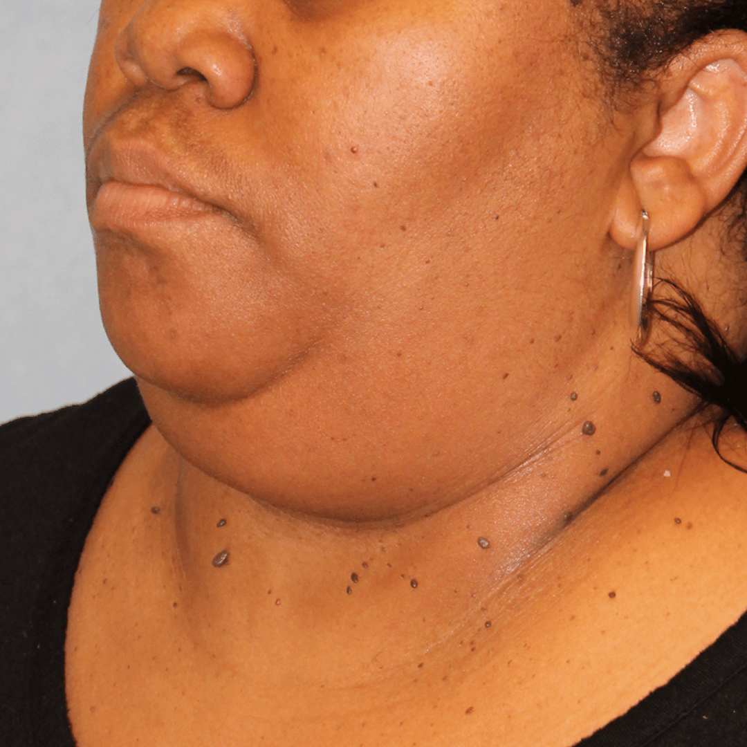 Before Image:  - left-front-oblique
