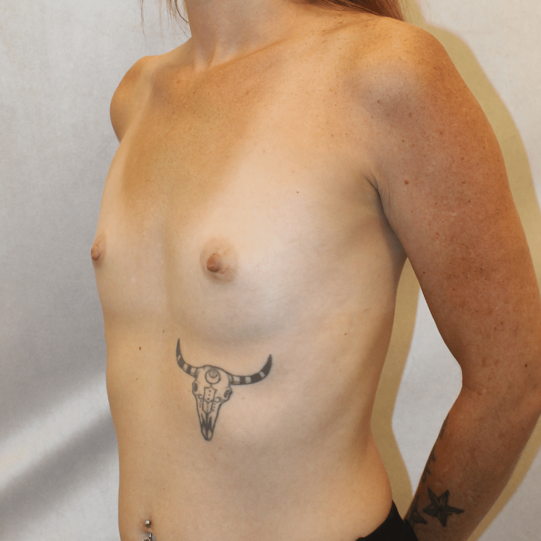 Before Image:  - left-front-oblique