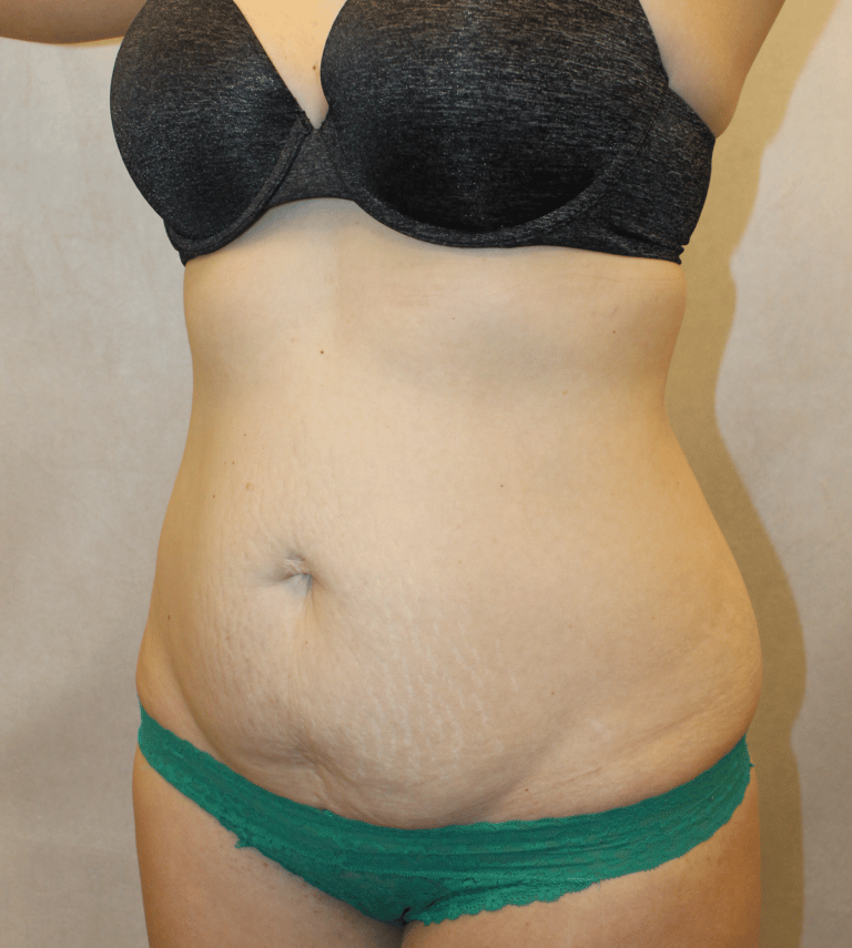 Before Image