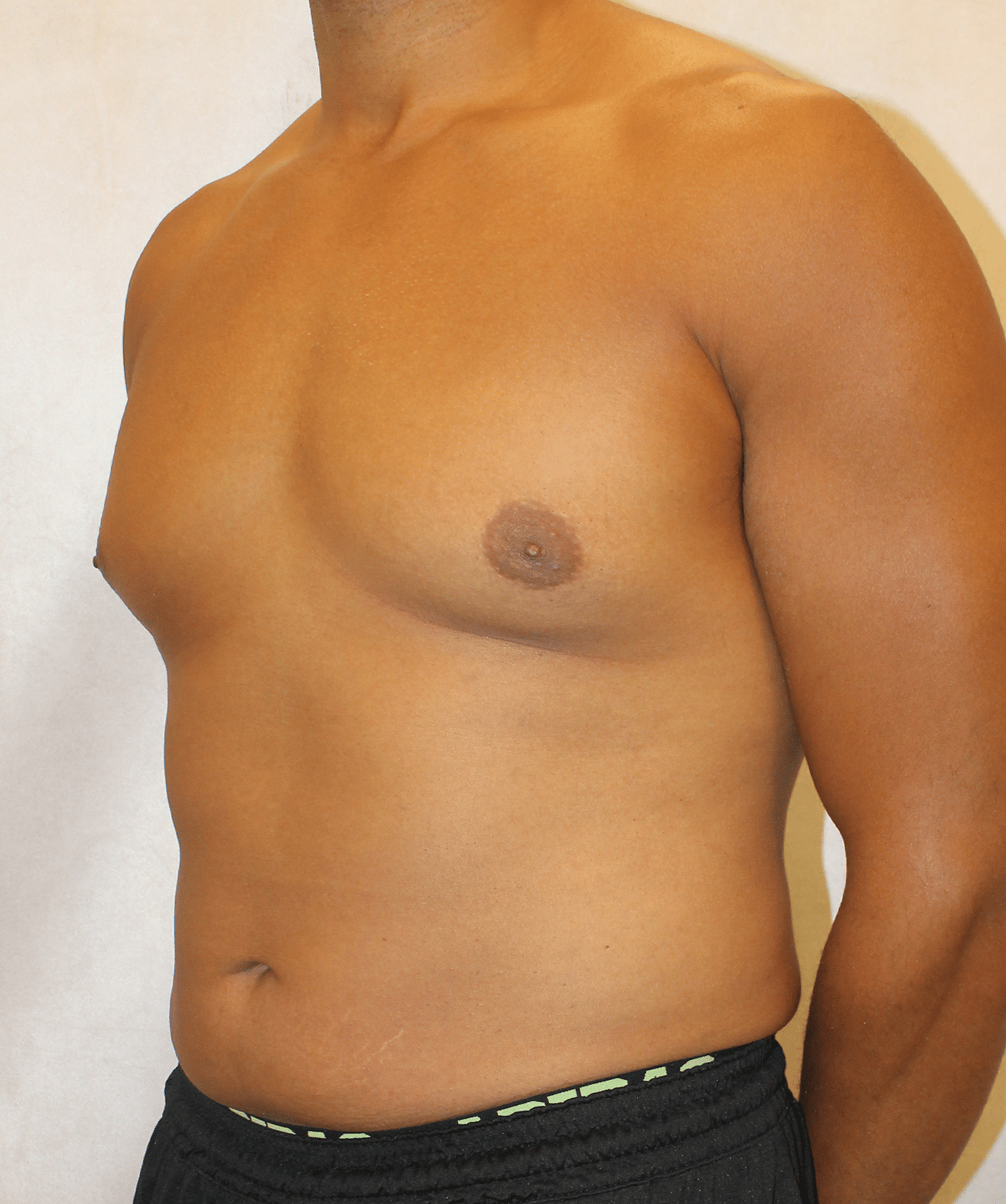 Before Image:  - left-front-oblique