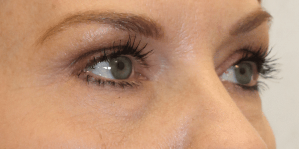 Before Image:  - right-front-oblique