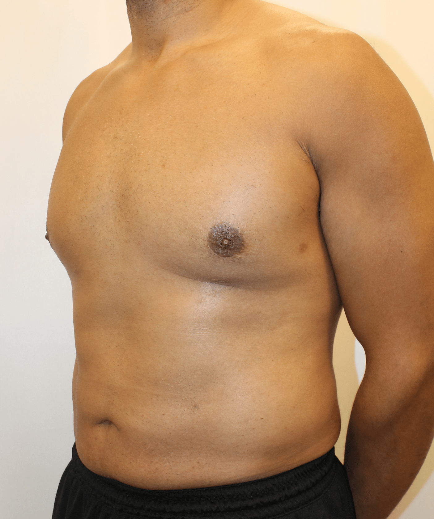 After Image:  - left-front-oblique