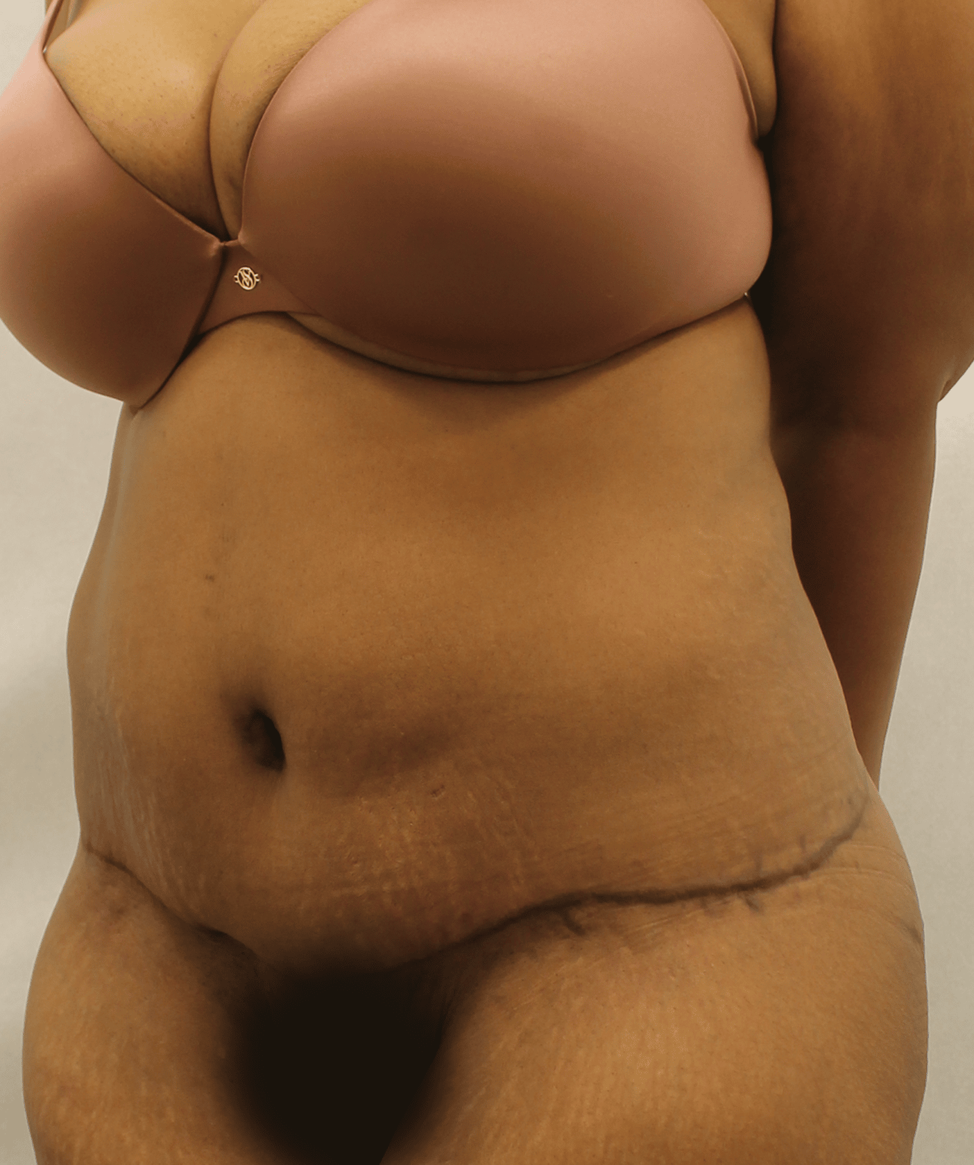 Before Image:  - left-front-oblique