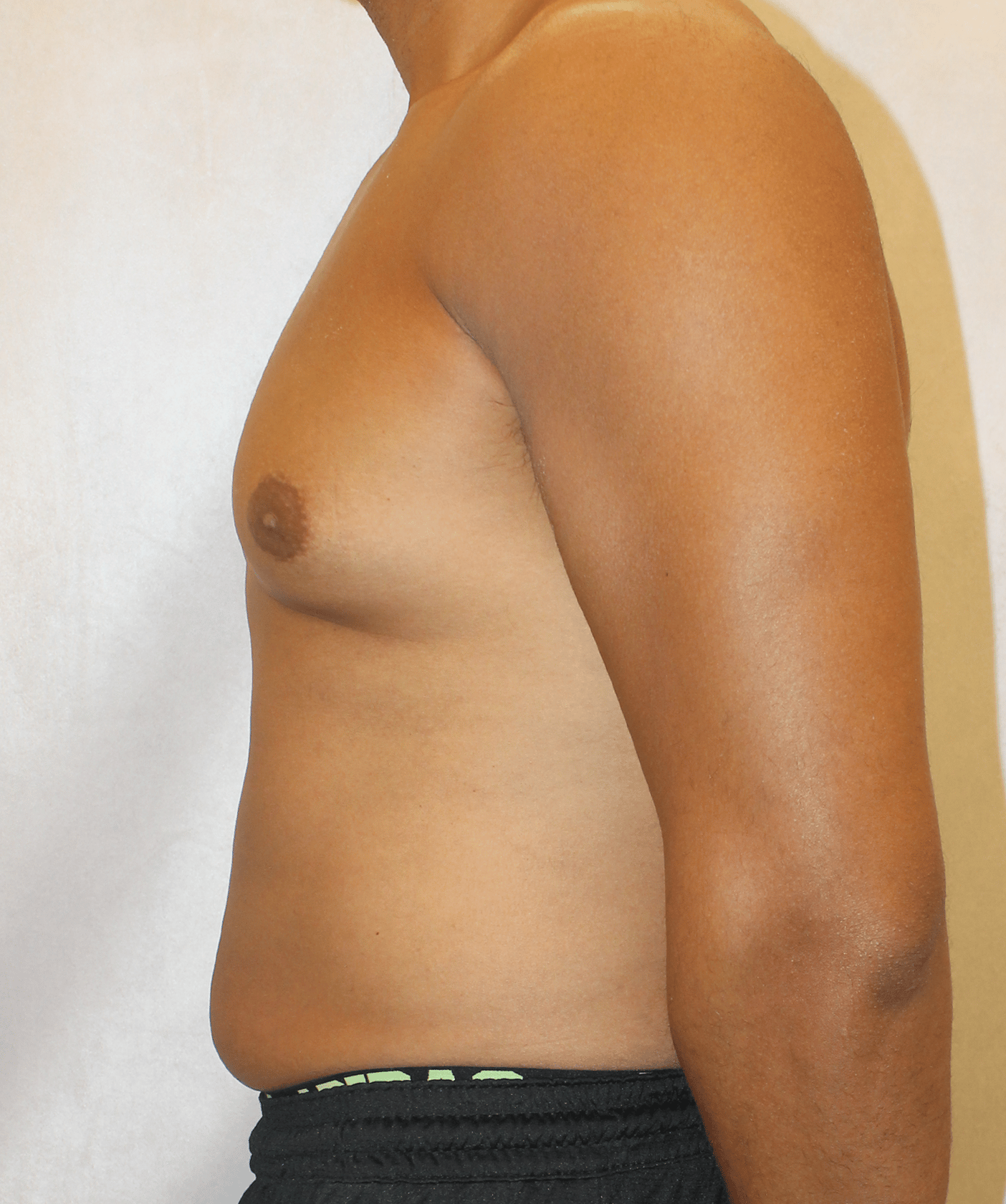 Before Image:  - left-side