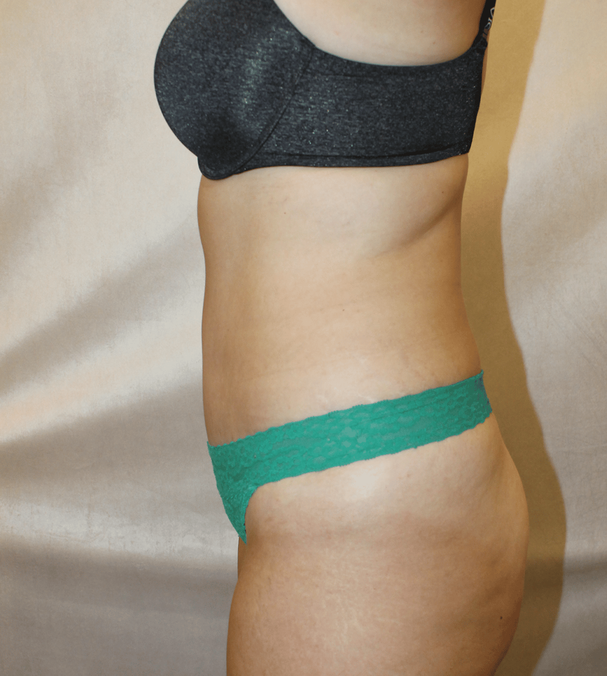 After Image:  - left-side