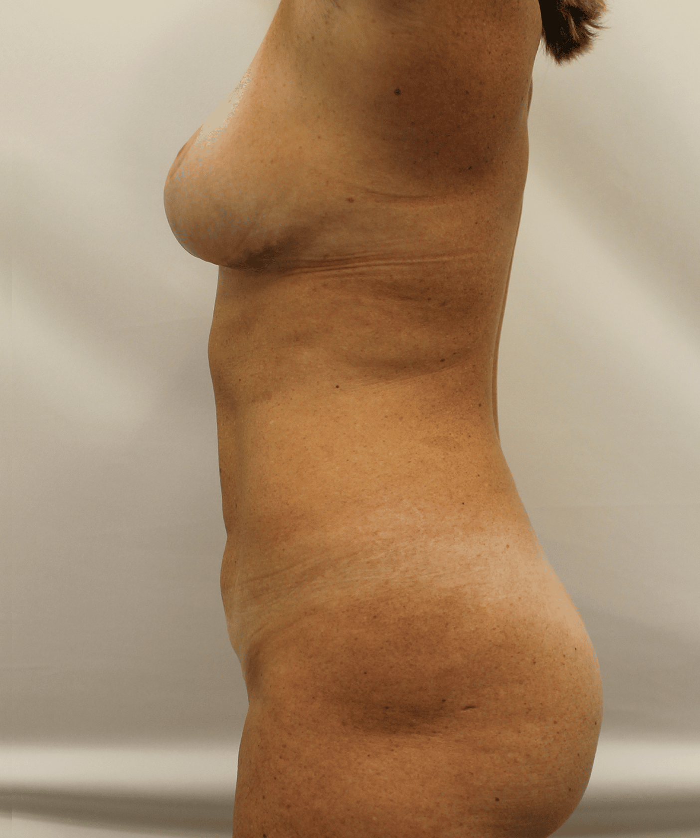 After Image:  - left-side