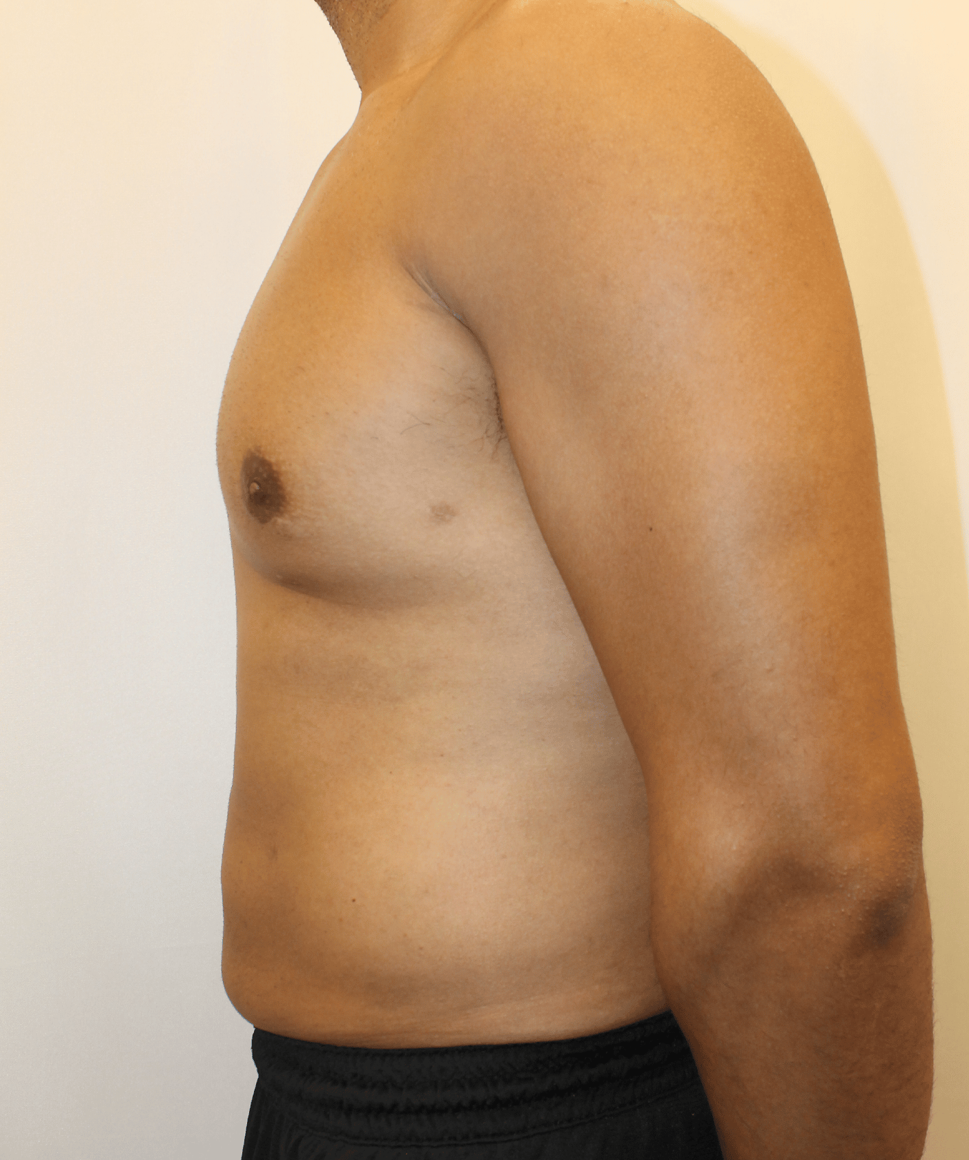 After Image:  - left-side