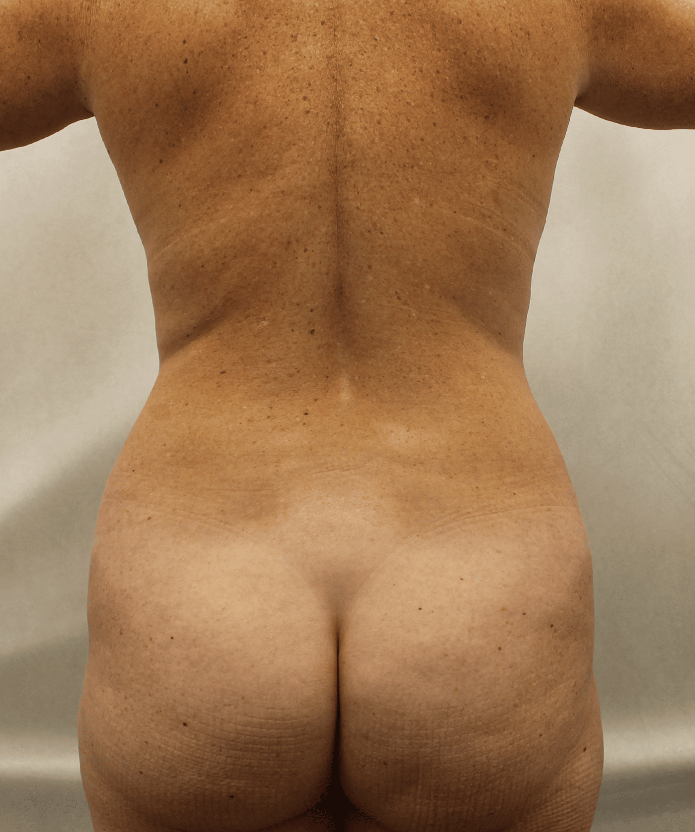 Before Image:  - back