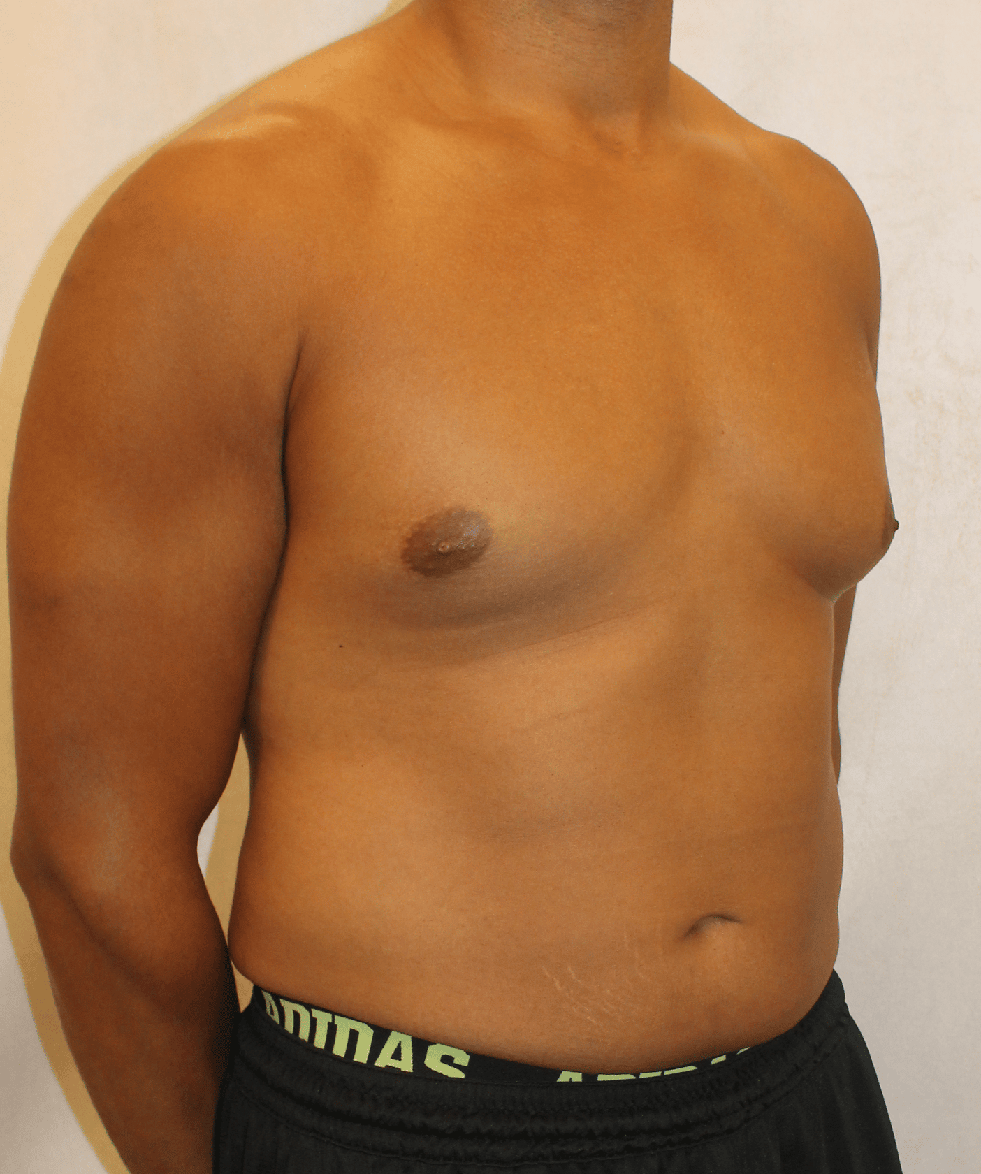 Before Image:  - right-front-oblique