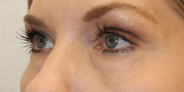 Before Image:  - left-front-oblique