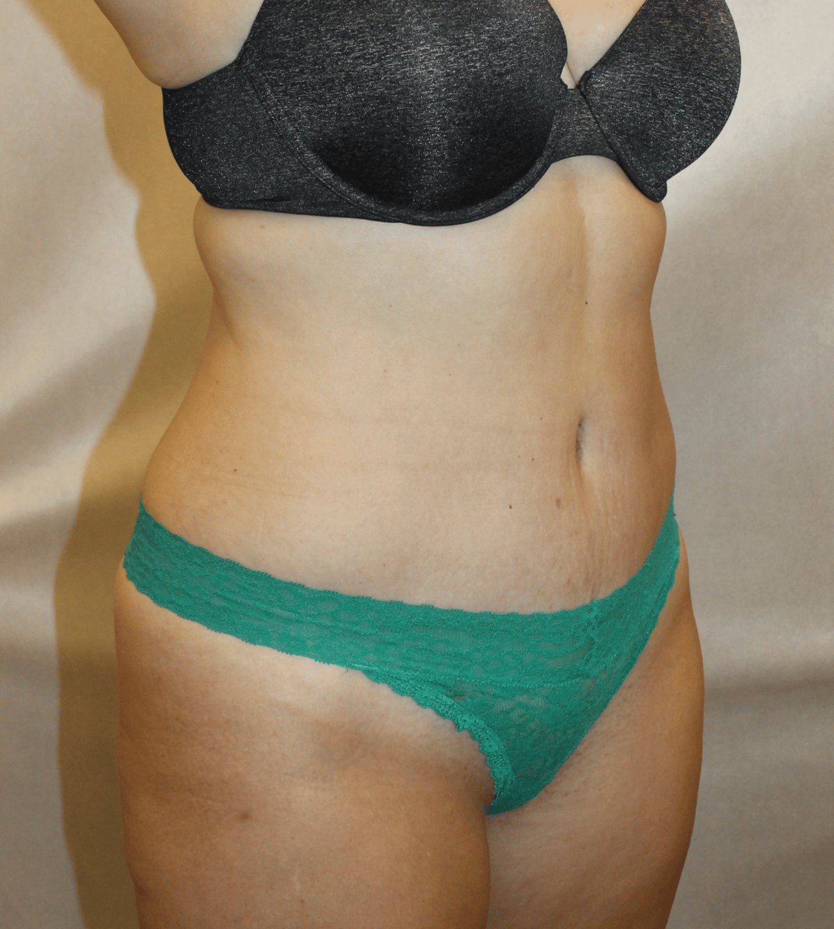 After Image:  - right-front-oblique