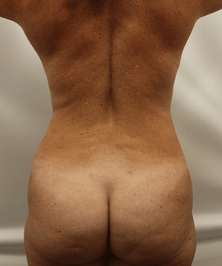 After Image