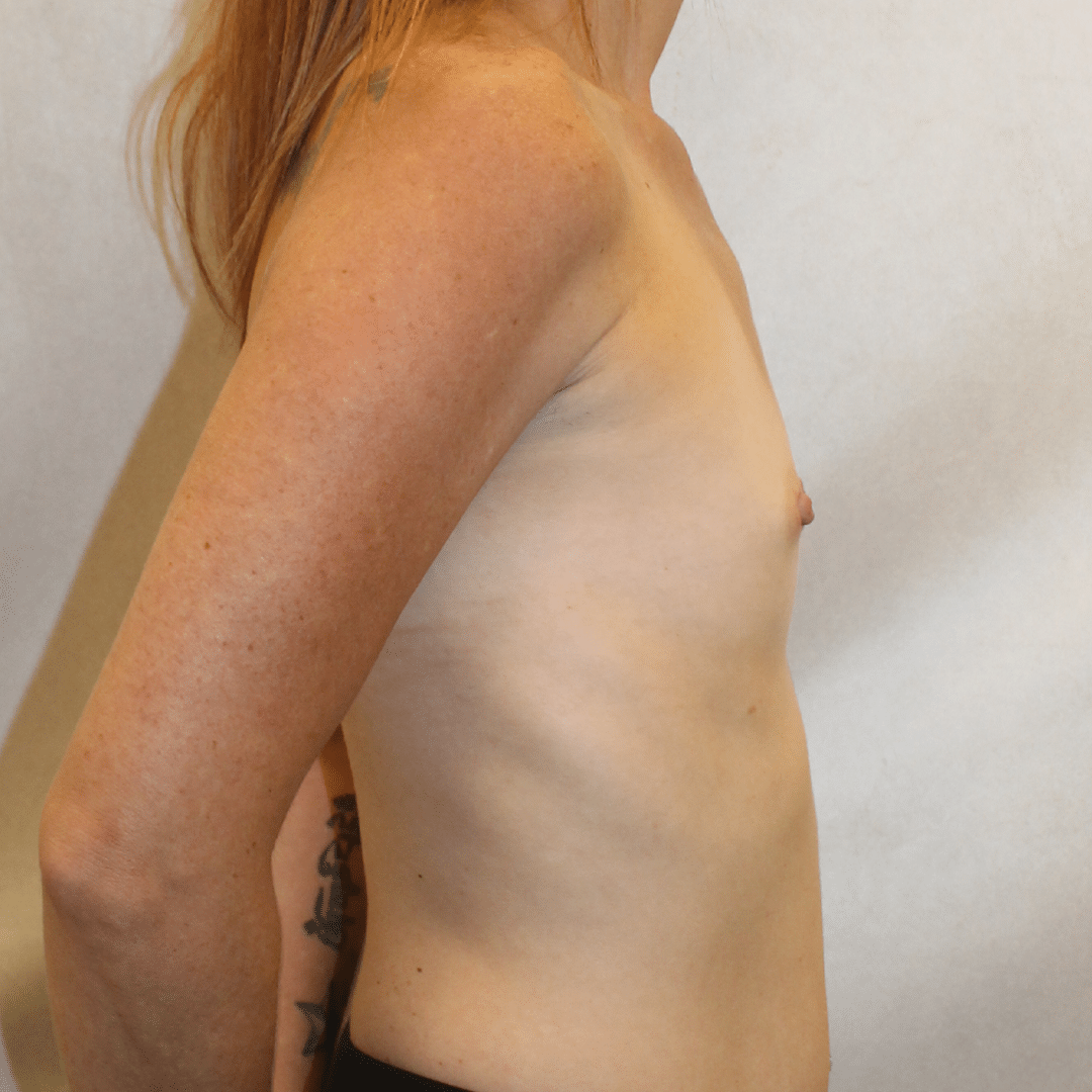 Before Image:  - right-side