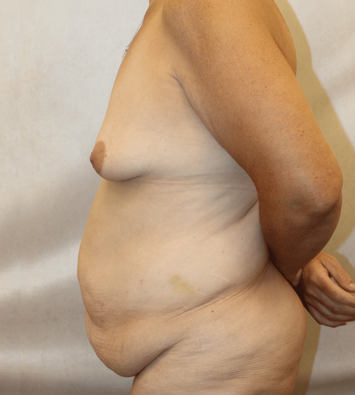 Before Image:  - left-side