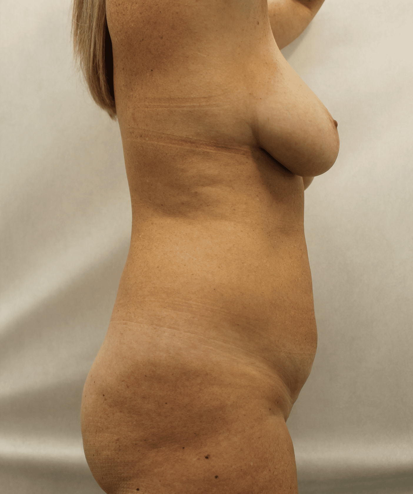 Before Image:  - right-side