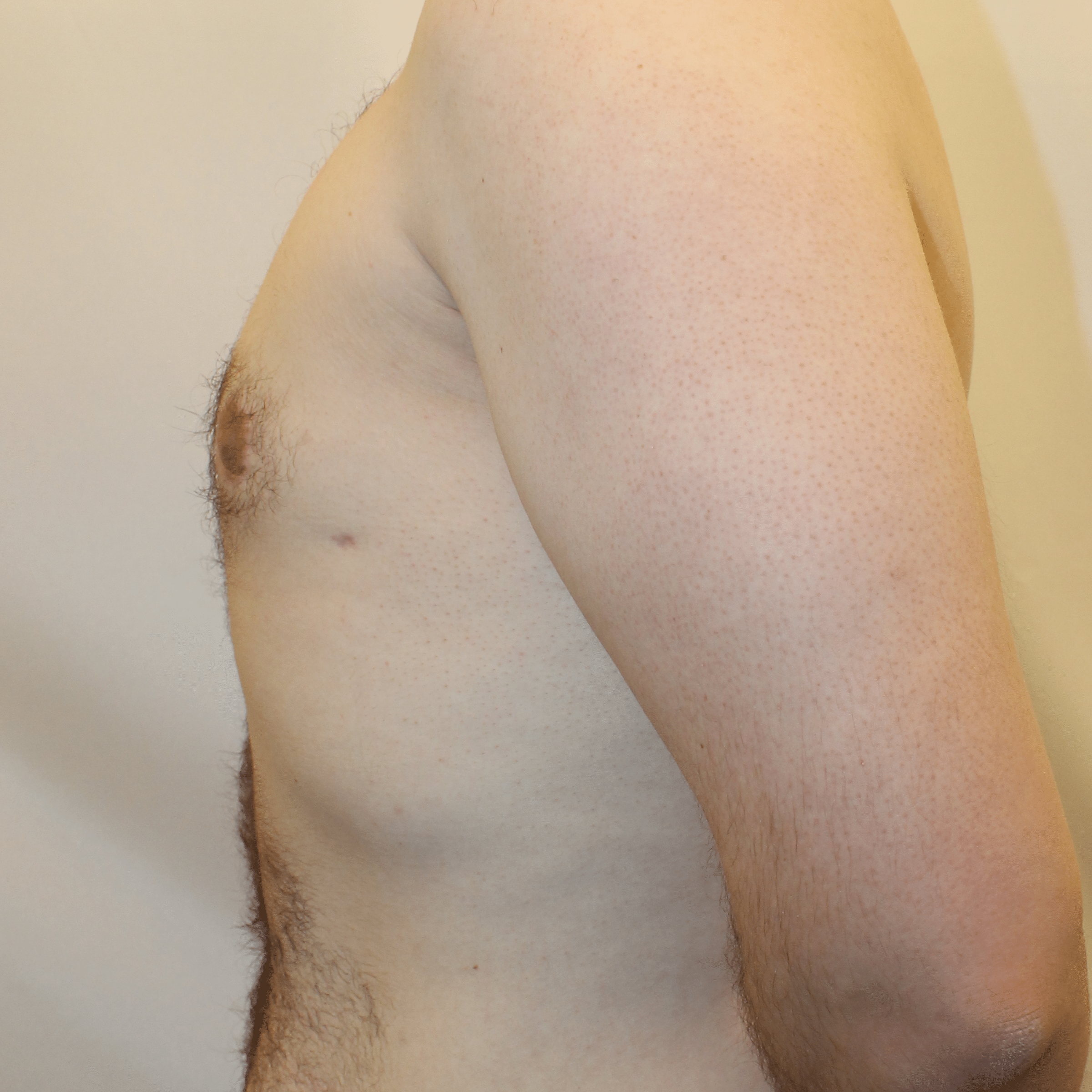 After Image:  - left-side