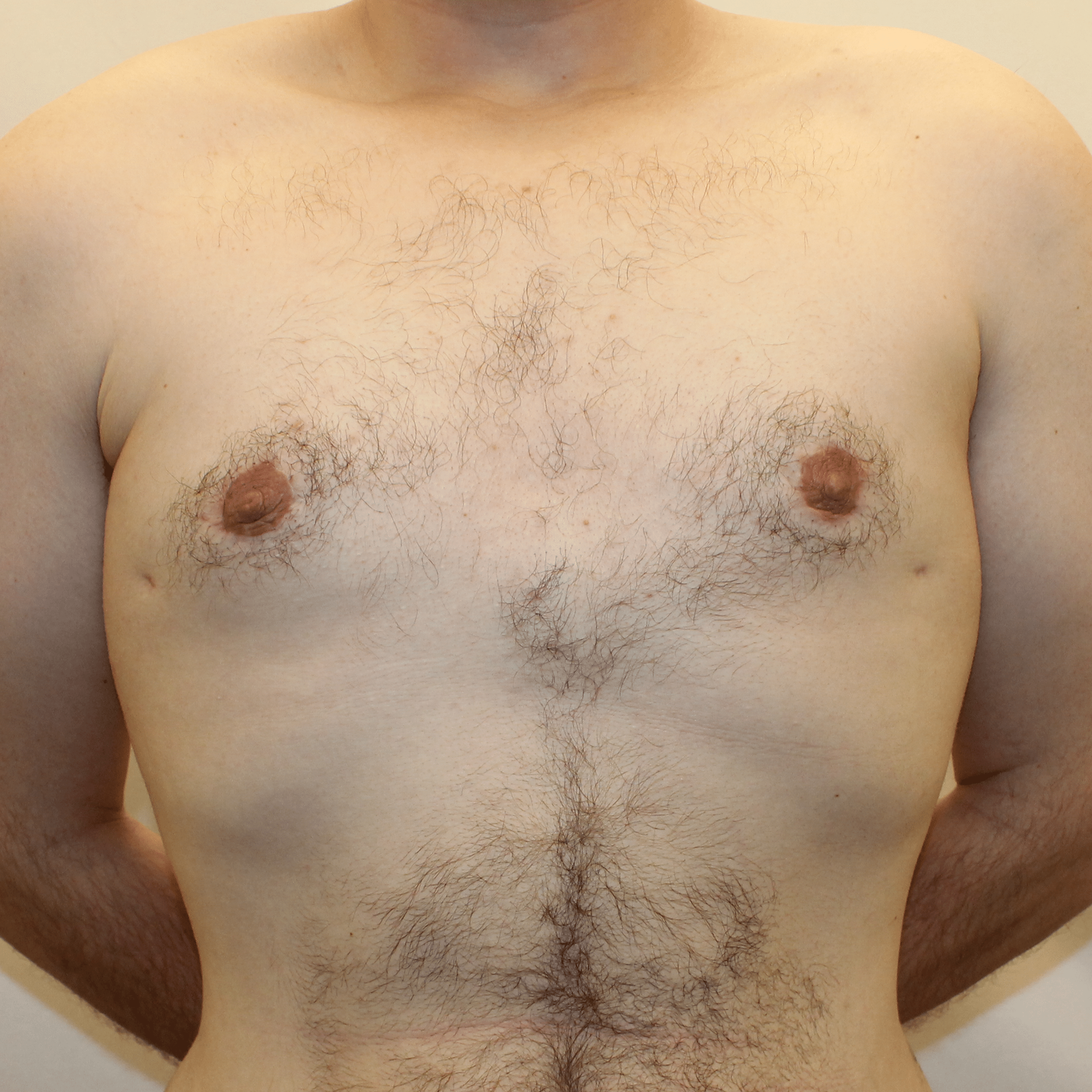 After Image: