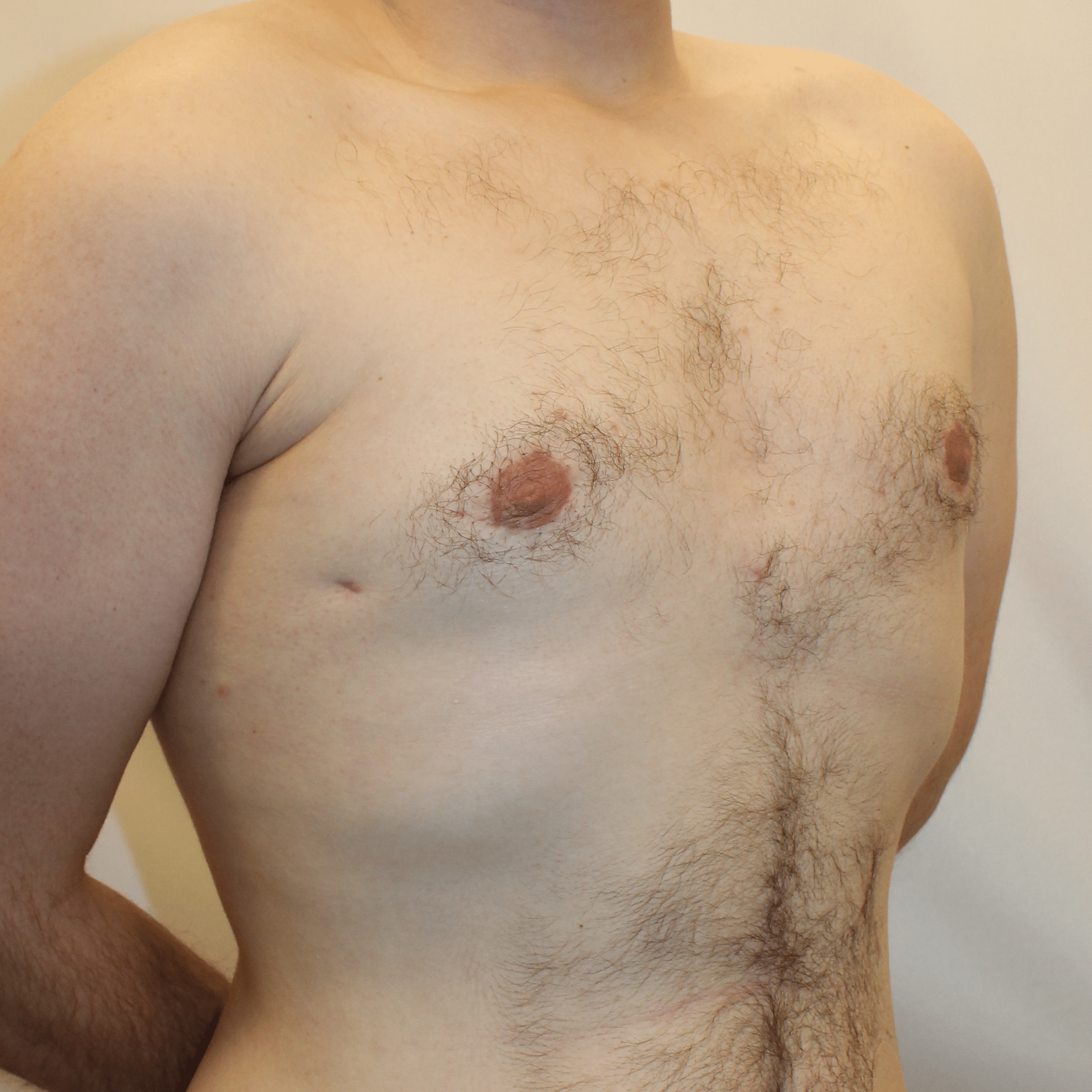 After Image:  - right-front-oblique